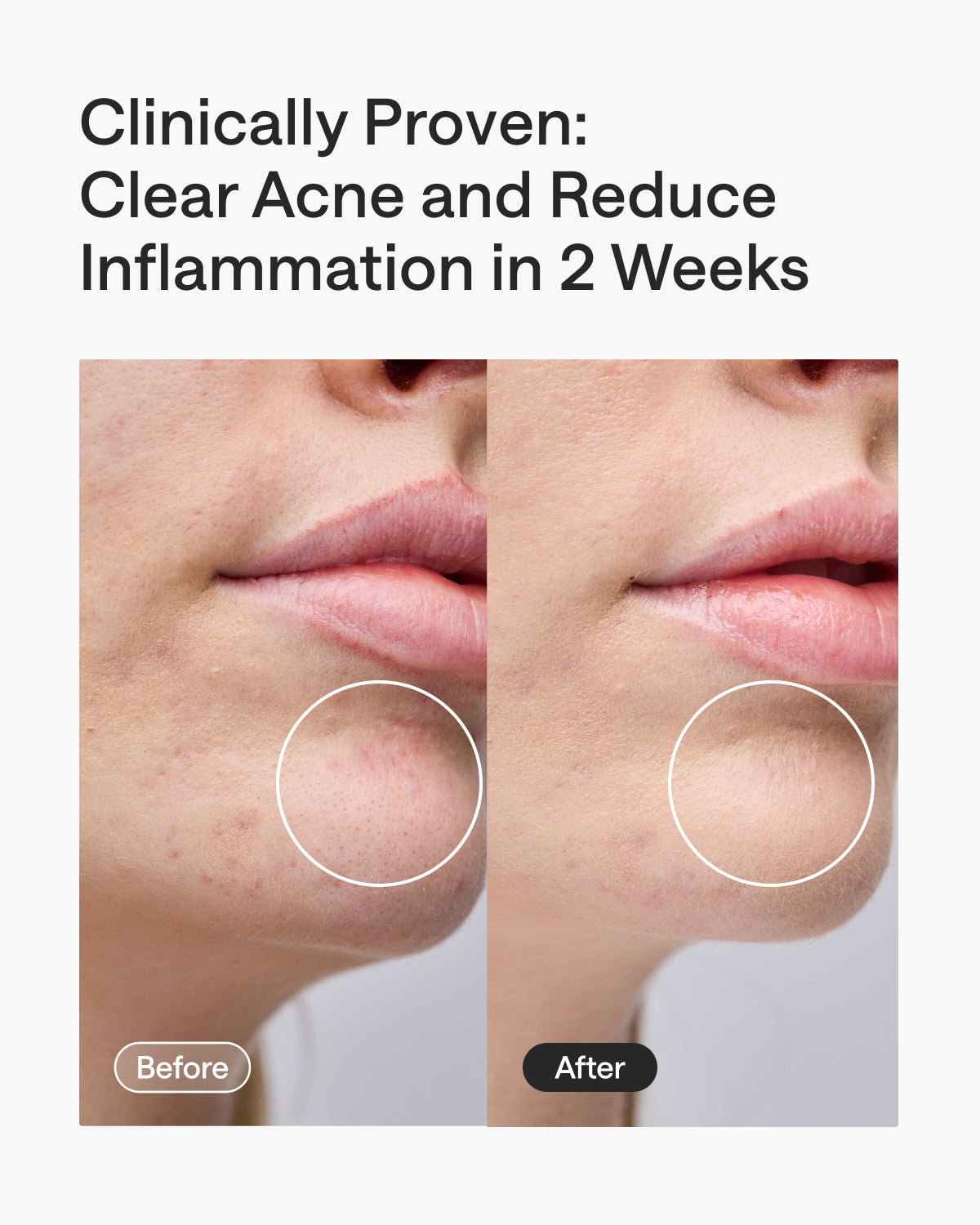 Ulike ReGlow LED Light Therapy Mask - Gold