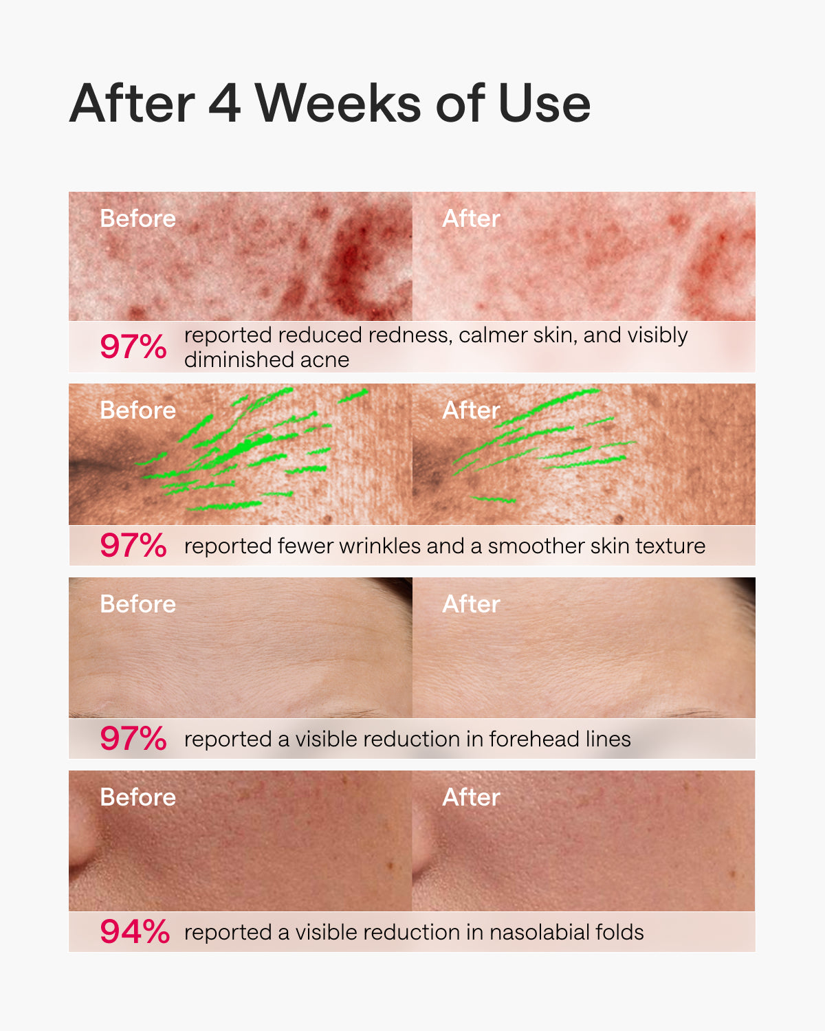 Ulike ReGlow LED Light Therapy Mask - Gold