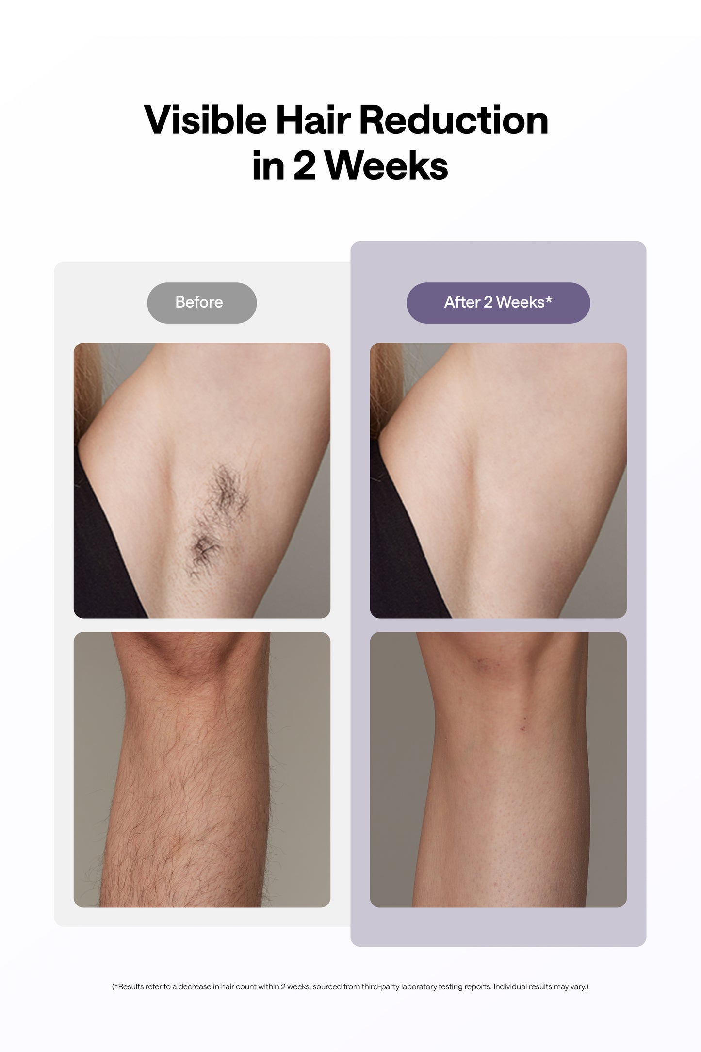 Ulike Air 10, Purple - IPL Hair Removal Device