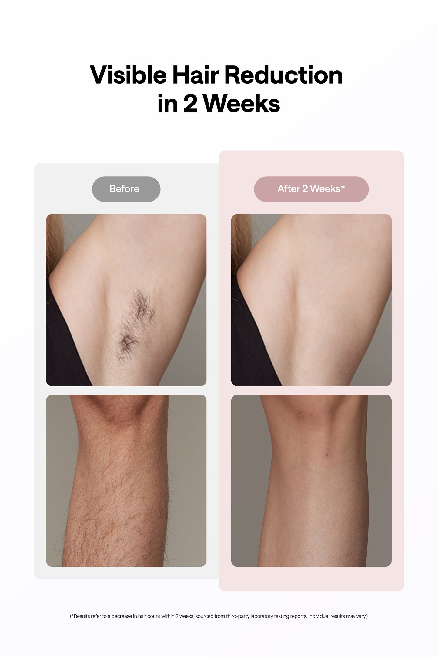 Ulike Air 10, Pink - IPL Hair Removal Device
