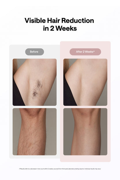 Ulike Air 10, Pink - IPL Hair Removal Device