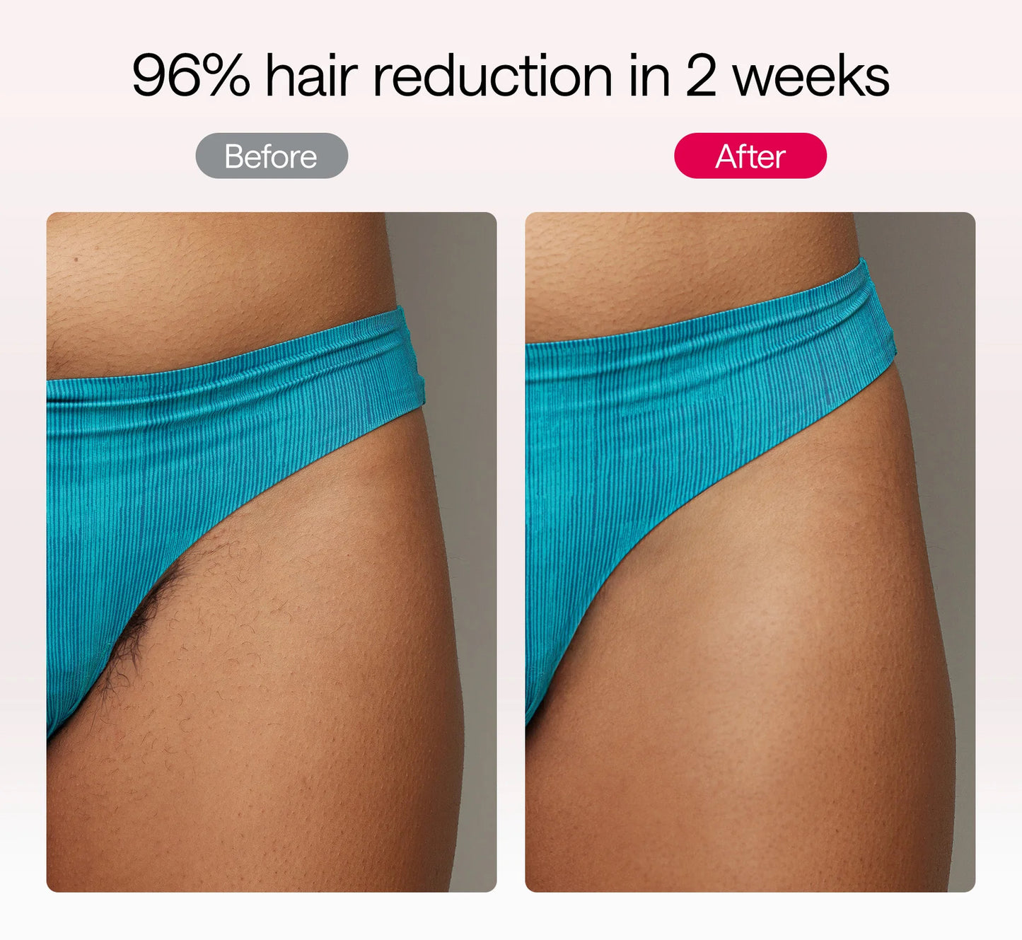 Ulike Air 10, Pink - IPL Hair Removal Device