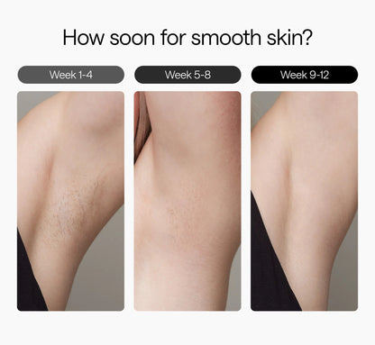 Ulike Air 3, Purple - IPL Hair Removal Device