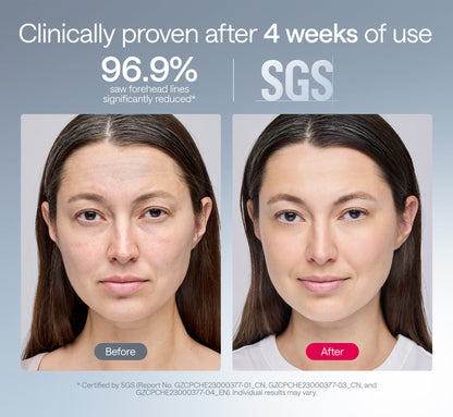 Ulike ReGlow LED Light Therapy Mask - Gold