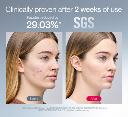 Ulike ReGlow LED Light Therapy Mask - Gold